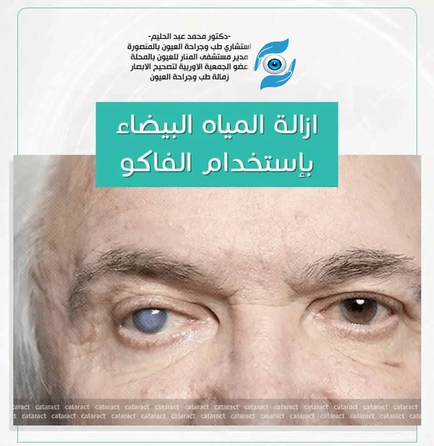 علاج المياه البيضاء على العين باستخدام الفاكو